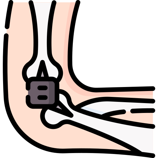 Cirugia de codo- clinica post quirurgica