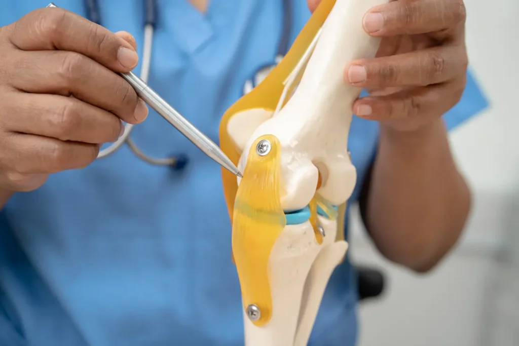 artroscopia de rodilla Cirugía mínimamente invasiva para tratar lesiones articulares frecuentes en Ecuador-clinica post quirúrgica