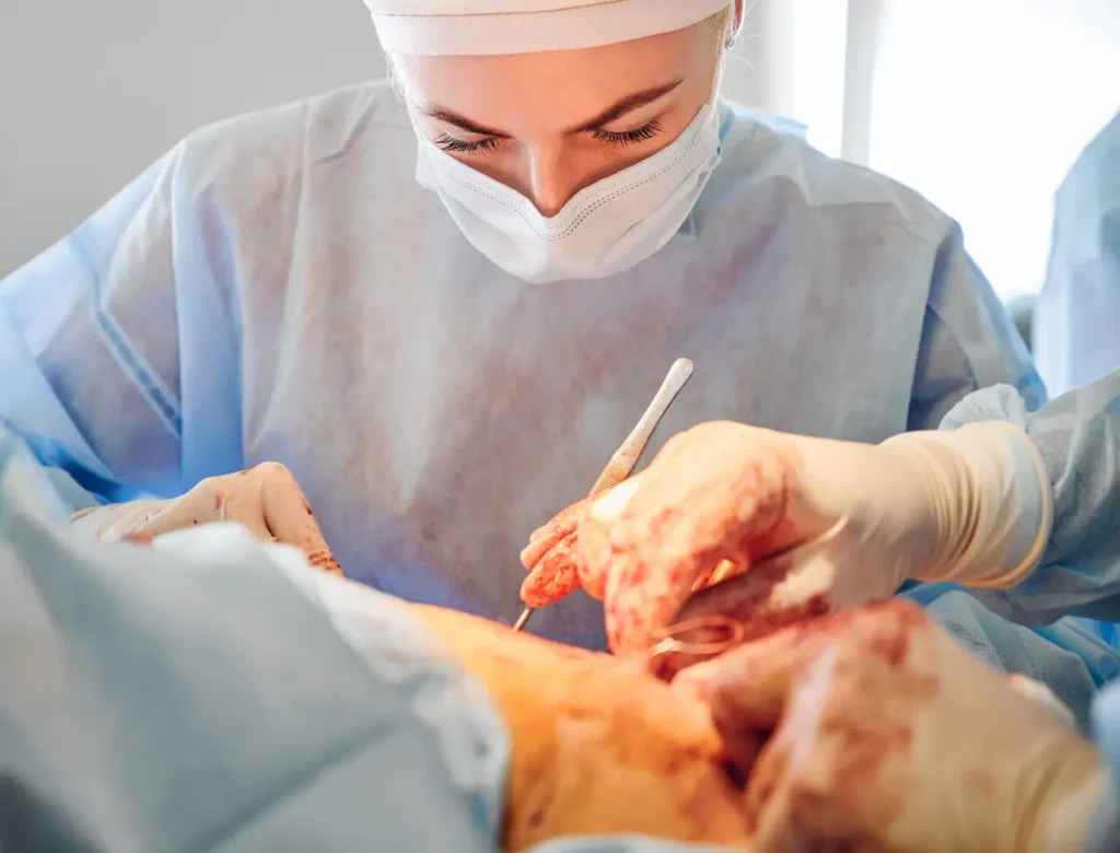 explicativa de una dislocación – cirugía de dislocación de hombro-clinica post quirúrgica